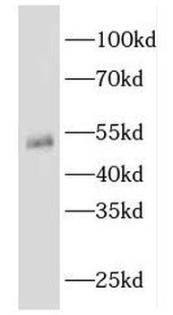 EEF1A1 Rabbit Polyclonal Antibody