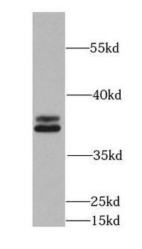 EEF1D Rabbit Polyclonal Antibody