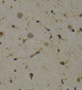 EEF1D Rabbit Polyclonal Antibody