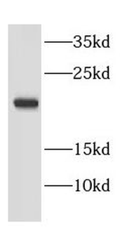 EEF1E1 Rabbit Polyclonal Antibody