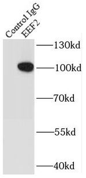 EEF2 Rabbit Polyclonal Antibody