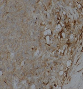 EEF2 Rabbit Polyclonal Antibody