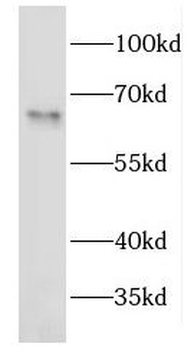 EEPD1 Rabbit Polyclonal Antibody