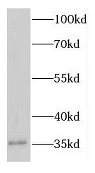 EFHD1 Rabbit Polyclonal Antibody