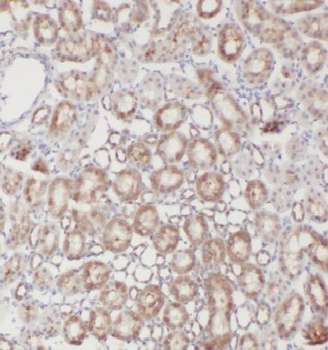 EFHD1 Rabbit Polyclonal Antibody