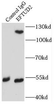EFTUD2 Rabbit Polyclonal Antibody