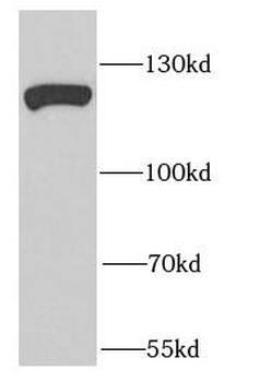 EFTUD2 Rabbit Polyclonal Antibody