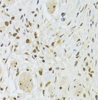 EFTUD2 Rabbit Polyclonal Antibody