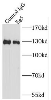 KIF11 Rabbit Polyclonal Antibody