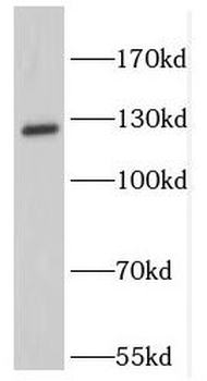KIF11 Rabbit Polyclonal Antibody