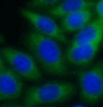 EHBP1 Rabbit Polyclonal Antibody