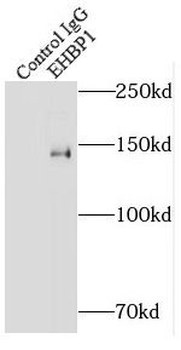 EHBP1 Rabbit Polyclonal Antibody