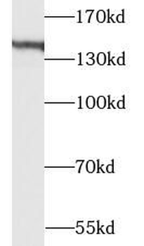 EHBP1 Rabbit Polyclonal Antibody
