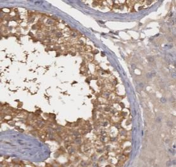 EHBP1 Rabbit Polyclonal Antibody