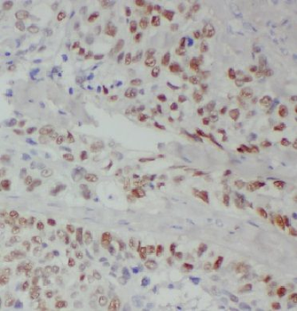 EHD2 Antibody