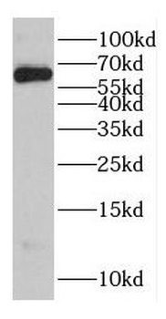 EHD3 Rabbit Polyclonal Antibody