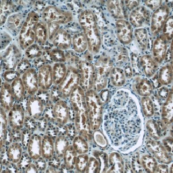 EIF1B Rabbit Polyclonal Antibody