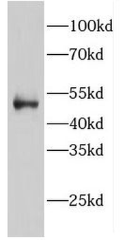 EIF2B3 Rabbit Polyclonal Antibody