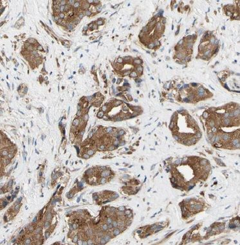 EIF2B3 Rabbit Polyclonal Antibody