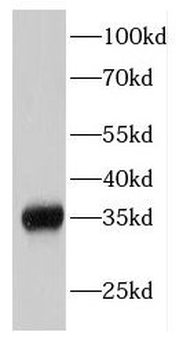 EIF2S1 Rabbit Polyclonal Antibody