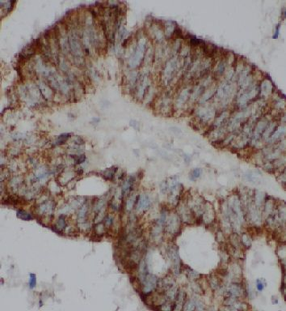EIF2S1 Rabbit Polyclonal Antibody