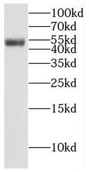EIF3E Rabbit Polyclonal Antibody