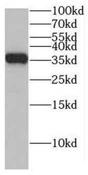 EIF3J Rabbit Polyclonal Antibody