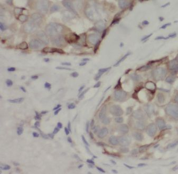EIF3J Rabbit Polyclonal Antibody
