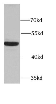 EIF4A2 Rabbit Polyclonal Antibody
