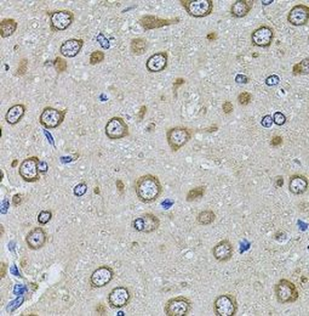 EIF4A2 Rabbit Polyclonal Antibody
