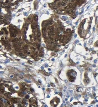 EIF4A2 Rabbit Polyclonal Antibody