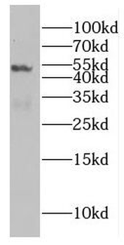 EIF4A3 Rabbit Polyclonal Antibody