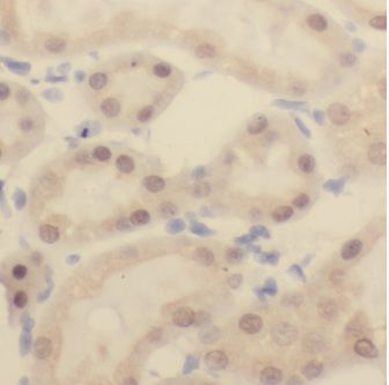 EIF4A3 Rabbit Polyclonal Antibody