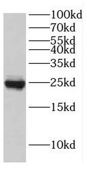 EIF4E3 Rabbit Polyclonal Antibody