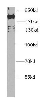 EIF4G1 Rabbit Polyclonal Antibody