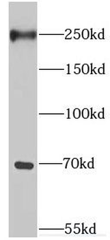 EIF4G3 Rabbit Polyclonal Antibody