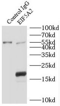 EIF5A2 Rabbit Polyclonal Antibody