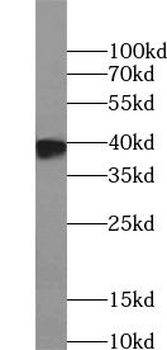 ELAVL2 Rabbit Polyclonal Antibody