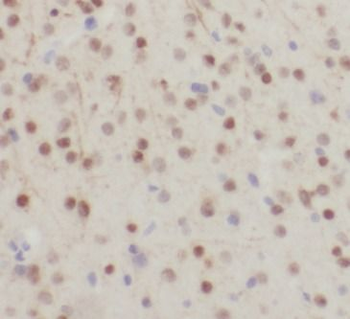 ELAVL2 Rabbit Polyclonal Antibody
