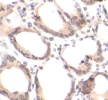 ELK1 Antibody