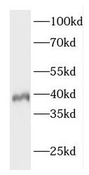 ELOVL4 Rabbit Polyclonal Antibody