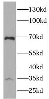 AIMP1 Antibody