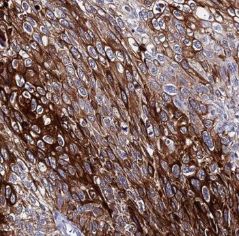 AIMP1 Antibody