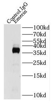 EMD Rabbit Polyclonal Antibody