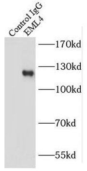 EML4 Rabbit Polyclonal Antibody