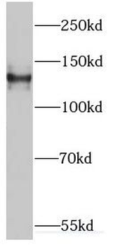 EML4 Rabbit Polyclonal Antibody
