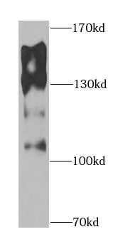 ENPEP Rabbit Polyclonal Antibody