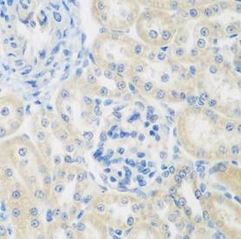 ENPEP Rabbit Polyclonal Antibody