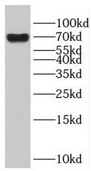 ENTPD2 Rabbit Polyclonal Antibody