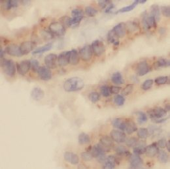 CCL11 Rabbit Polyclonal Antibody